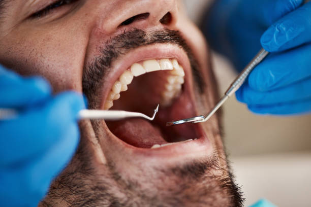 Emergency Dental Services in Nellysford, VA